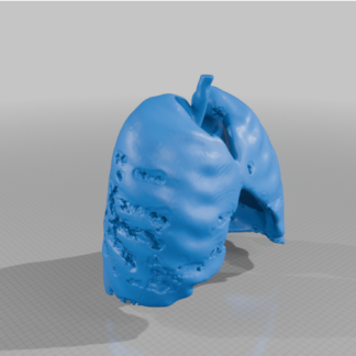 COVID 19 Segmentasyonlu Akciğer 6748814